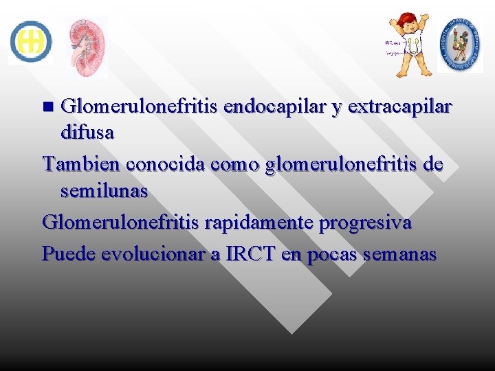 Glomerulonefritis endocapilar y extracapilar difusa Tambien conocida como glomerulonefritis de semilunas Glomerulonefritis rapidamente progresiva