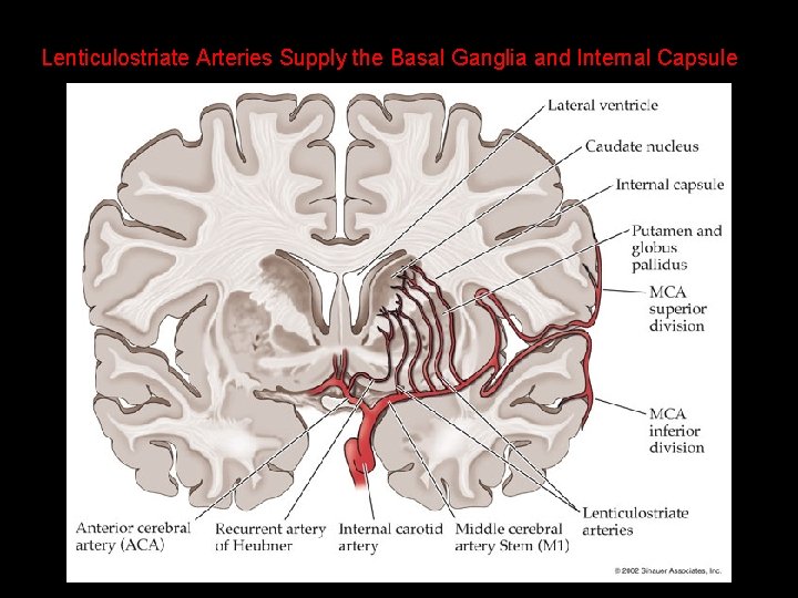 Lenticulostriate Arteries Supply the Basal Ganglia and Internal Capsule 