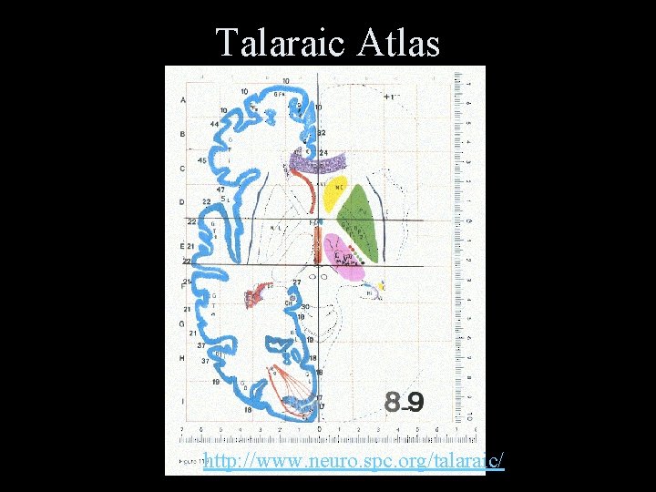 Talaraic Atlas http: //www. neuro. spc. org/talaraic/ 