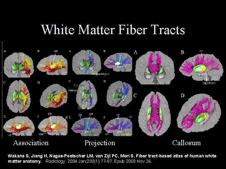 White Matter Fiber Tracts Association Projection Callosum Wakana S, Jiang H, Nagae-Poetscher LM, van