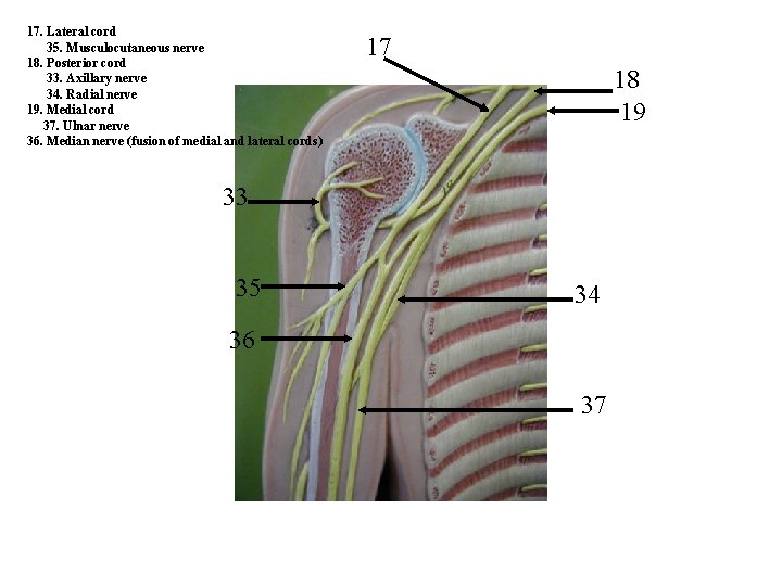 17. Lateral cord 35. Musculocutaneous nerve 18. Posterior cord 33. Axillary nerve 34. Radial