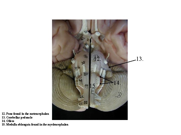 12. 15. 12. Pons found in the metencephalon 13. Cerebellar peduncle 14. Olives 15. 12. 15. 12. Pons found in the metencephalon 13. Cerebellar peduncle 14. Olives 15.