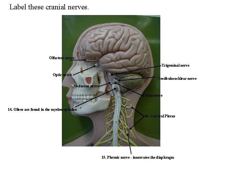 Label these cranial nerves. Olfactory nerve Trigeminal nerve Optic nerve Vestibulocochlear nerve Abducens nerve