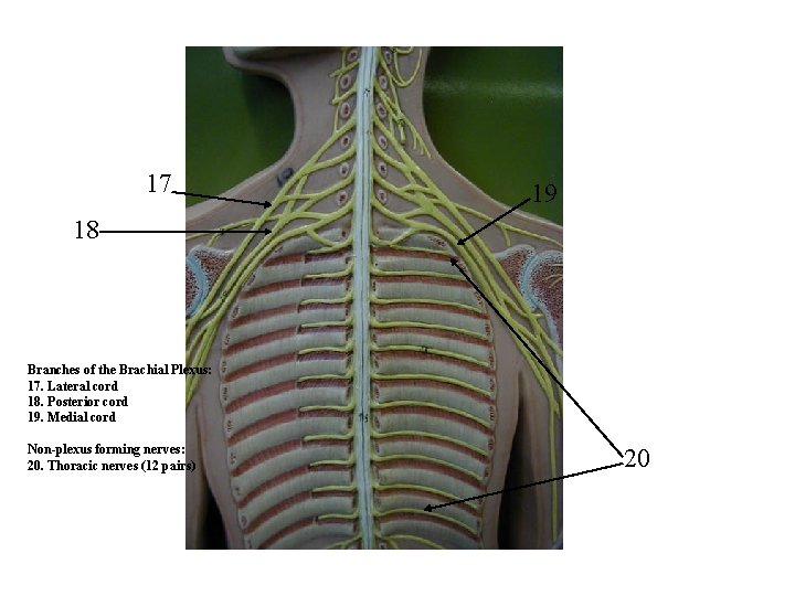 17 19 18 Branches of the Brachial Plexus: 17. Lateral cord 18. Posterior cord 17 19 18 Branches of the Brachial Plexus: 17. Lateral cord 18. Posterior cord