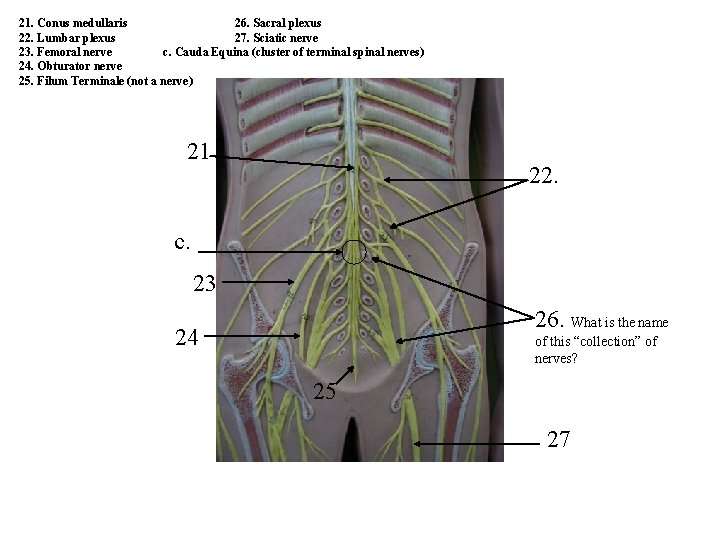 21. Conus medullaris 26. Sacral plexus 22. Lumbar plexus 27. Sciatic nerve 23. Femoral 21. Conus medullaris 26. Sacral plexus 22. Lumbar plexus 27. Sciatic nerve 23. Femoral