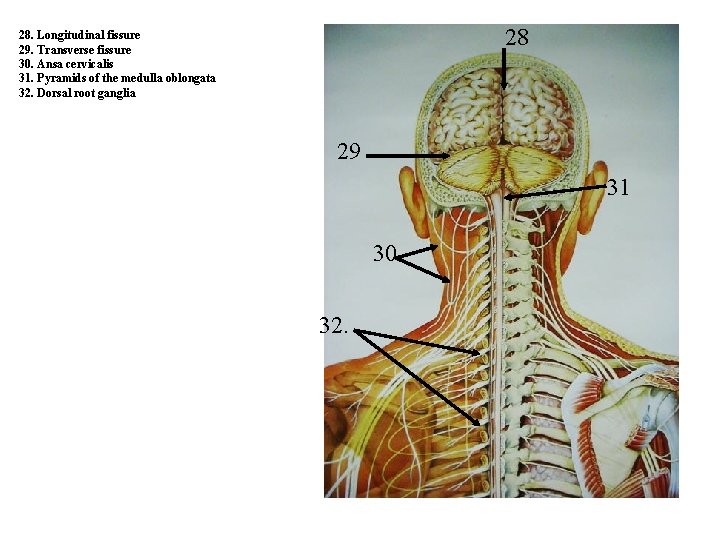 28 28. Longitudinal fissure 29. Transverse fissure 30. Ansa cervicalis 31. Pyramids of the 28 28. Longitudinal fissure 29. Transverse fissure 30. Ansa cervicalis 31. Pyramids of the