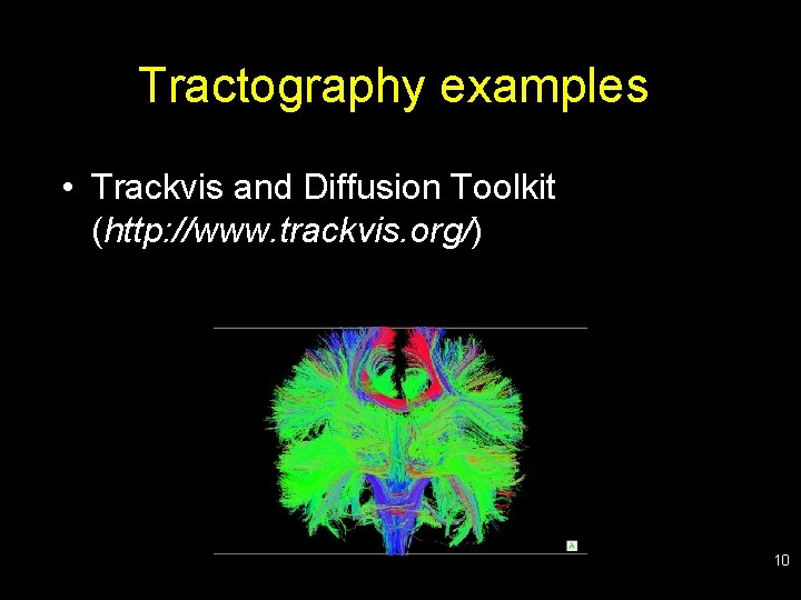 Tractography examples • Trackvis and Diffusion Toolkit (http: //www. trackvis. org/) 10 