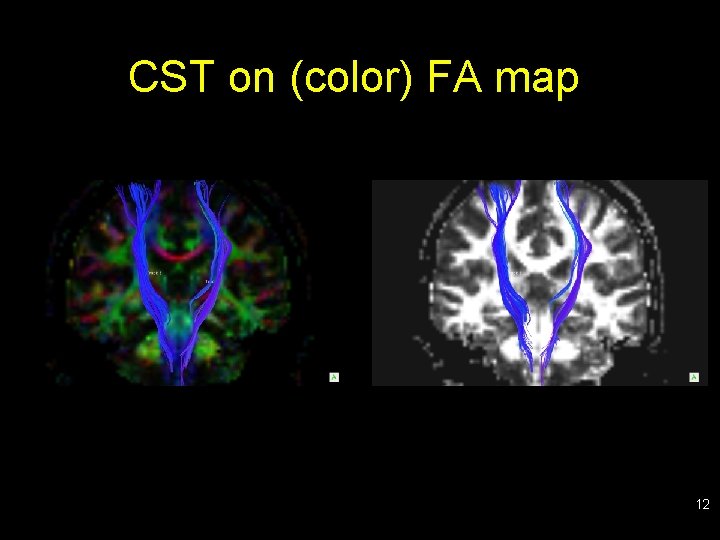 CST on (color) FA map 12 