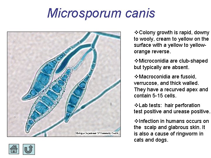 Microsporum canis Colony growth is rapid, downy to wooly, cream to yellow on the Microsporum canis Colony growth is rapid, downy to wooly, cream to yellow on the