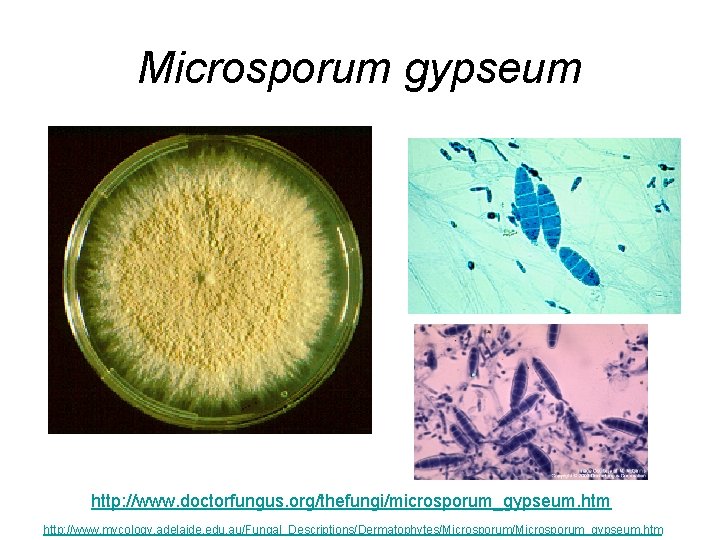 Microsporum gypseum http: //www. doctorfungus. org/thefungi/microsporum_gypseum. htm http: //www. mycology. adelaide. edu. au/Fungal_Descriptions/Dermatophytes/Microsporum_gypseum. htm Microsporum gypseum http: //www. doctorfungus. org/thefungi/microsporum_gypseum. htm http: //www. mycology. adelaide. edu. au/Fungal_Descriptions/Dermatophytes/Microsporum_gypseum. htm