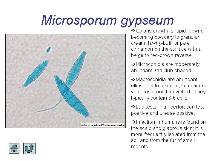 Microsporum gypseum Colony growth is rapid, downy, becoming powdery to granular, cream, tawny-buff, or Microsporum gypseum Colony growth is rapid, downy, becoming powdery to granular, cream, tawny-buff, or