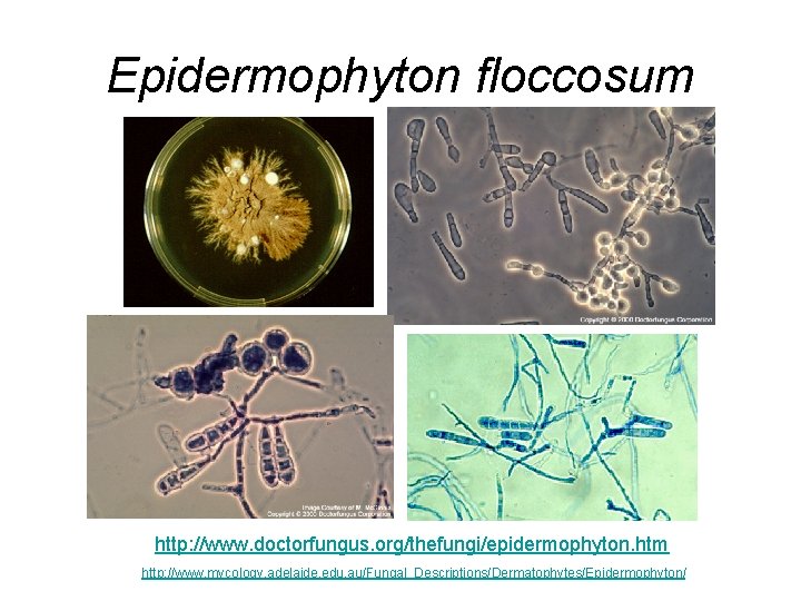 Epidermophyton floccosum http: //www. doctorfungus. org/thefungi/epidermophyton. htm http: //www. mycology. adelaide. edu. au/Fungal_Descriptions/Dermatophytes/Epidermophyton/ Epidermophyton floccosum http: //www. doctorfungus. org/thefungi/epidermophyton. htm http: //www. mycology. adelaide. edu. au/Fungal_Descriptions/Dermatophytes/Epidermophyton/