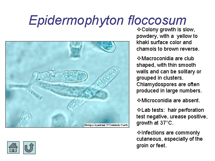 Epidermophyton floccosum Colony growth is slow, powdery, with a yellow to khaki surface color Epidermophyton floccosum Colony growth is slow, powdery, with a yellow to khaki surface color