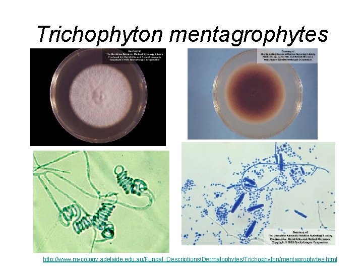 Trichophyton mentagrophytes http: //www. mycology. adelaide. edu. au/Fungal_Descriptions/Dermatophytes/Trichophyton/mentagrophytes. html Trichophyton mentagrophytes http: //www. mycology. adelaide. edu. au/Fungal_Descriptions/Dermatophytes/Trichophyton/mentagrophytes. html