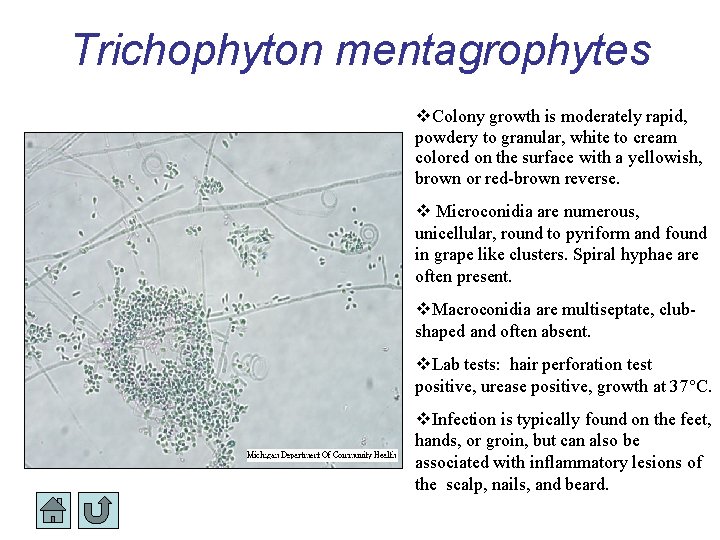 Trichophyton mentagrophytes Colony growth is moderately rapid, powdery to granular, white to cream colored Trichophyton mentagrophytes Colony growth is moderately rapid, powdery to granular, white to cream colored