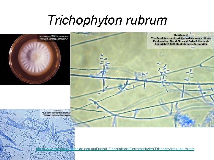 Trichophyton rubrum http: //www. mycology. adelaide. edu. au/Fungal_Descriptions/Dermatophytes/Trichophyton/rubrum. htm Trichophyton rubrum http: //www. mycology. adelaide. edu. au/Fungal_Descriptions/Dermatophytes/Trichophyton/rubrum. htm