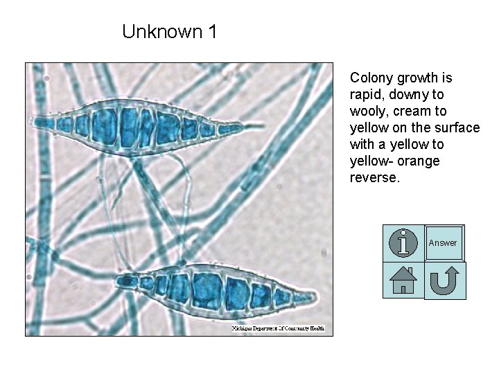 Unknown 1 Colony growth is rapid, downy to wooly, cream to yellow on the Unknown 1 Colony growth is rapid, downy to wooly, cream to yellow on the