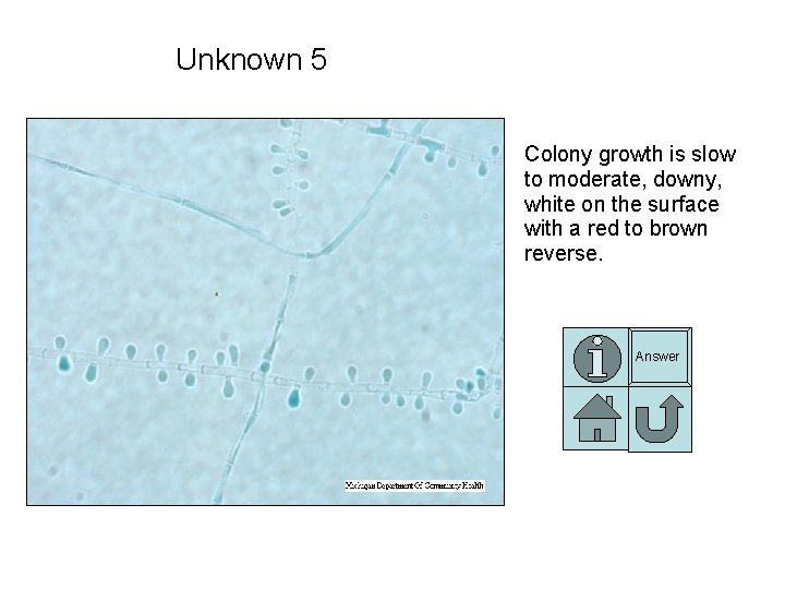 Unknown 5 Colony growth is slow to moderate, downy, white on the surface with Unknown 5 Colony growth is slow to moderate, downy, white on the surface with