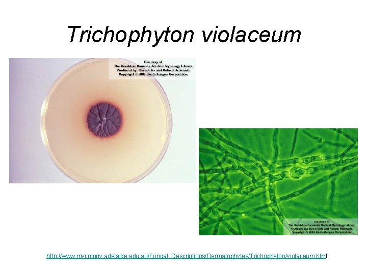 Trichophyton violaceum http: //www. mycology. adelaide. edu. au/Fungal_Descriptions/Dermatophytes/Trichophyton/violaceum. html Trichophyton violaceum http: //www. mycology. adelaide. edu. au/Fungal_Descriptions/Dermatophytes/Trichophyton/violaceum. html