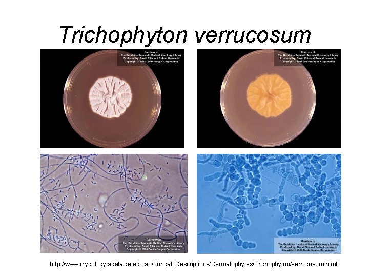Trichophyton verrucosum http: //www. mycology. adelaide. edu. au/Fungal_Descriptions/Dermatophytes/Trichophyton/verrucosum. html Trichophyton verrucosum http: //www. mycology. adelaide. edu. au/Fungal_Descriptions/Dermatophytes/Trichophyton/verrucosum. html