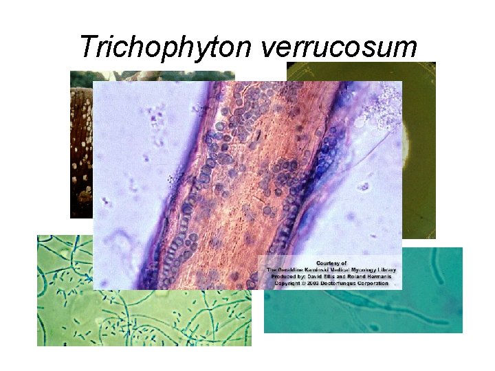 Trichophyton verrucosum Trichophyton verrucosum