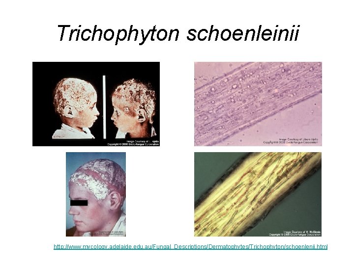 Trichophyton schoenleinii http: //www. mycology. adelaide. edu. au/Fungal_Descriptions/Dermatophytes/Trichophyton/schoenlenii. html Trichophyton schoenleinii http: //www. mycology. adelaide. edu. au/Fungal_Descriptions/Dermatophytes/Trichophyton/schoenlenii. html