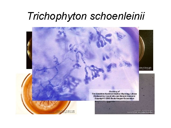 Trichophyton schoenleinii Trichophyton schoenleinii