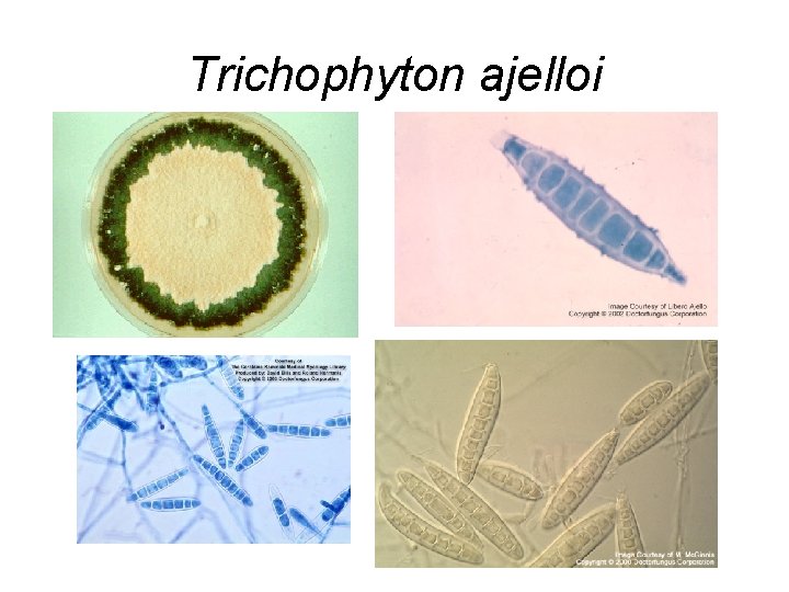 Trichophyton ajelloi Trichophyton ajelloi