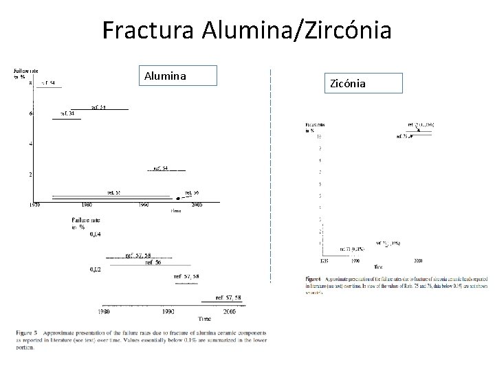 Fractura Alumina/Zircónia Alumina Zicónia 