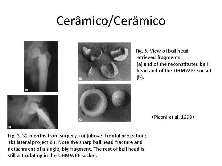 Cerâmico/Cerâmico Fig. 5. View of ball head retrieved fragments (a) and of the reconstituted