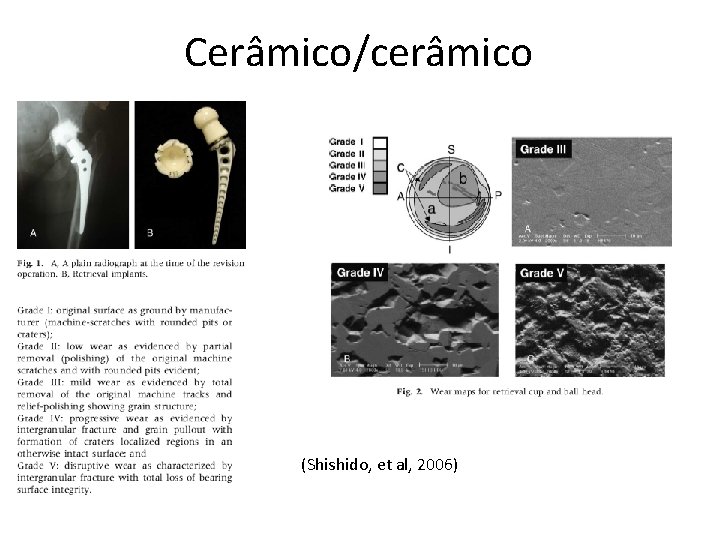 Cerâmico/cerâmico (Shishido, et al, 2006) 