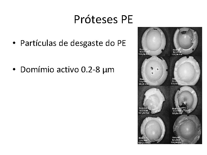 Próteses PE • Partículas de desgaste do PE • Domímio activo 0. 2 -8