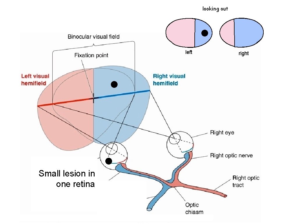 looking out left Small lesion in one retina right 