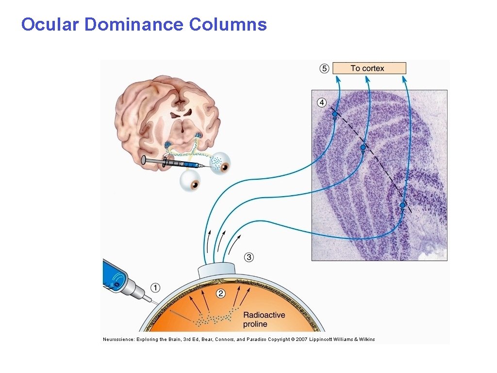 Ocular Dominance Columns 