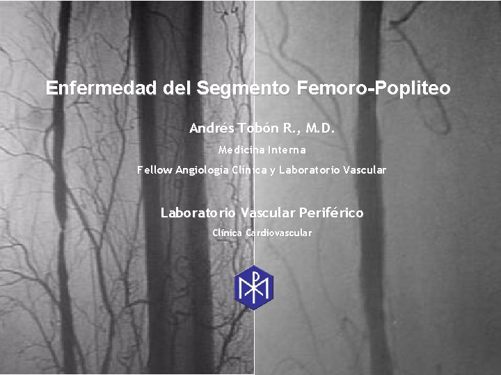 Enfermedad del Segmento Femoro-Popliteo Andrés Tobón R. , M. D. Medicina Interna Fellow Angiología
