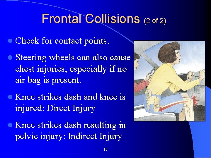 Frontal Collisions (2 of 2) l Check for contact points. l Steering wheels can Frontal Collisions (2 of 2) l Check for contact points. l Steering wheels can