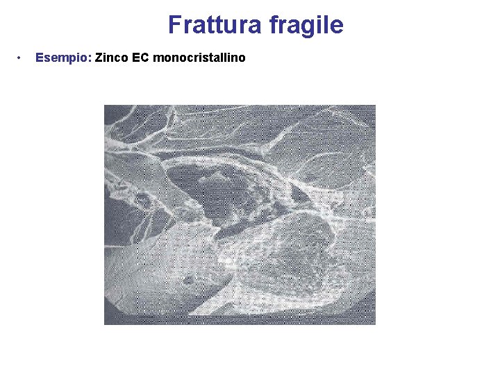 Frattura fragile • Esempio: Zinco EC monocristallino 