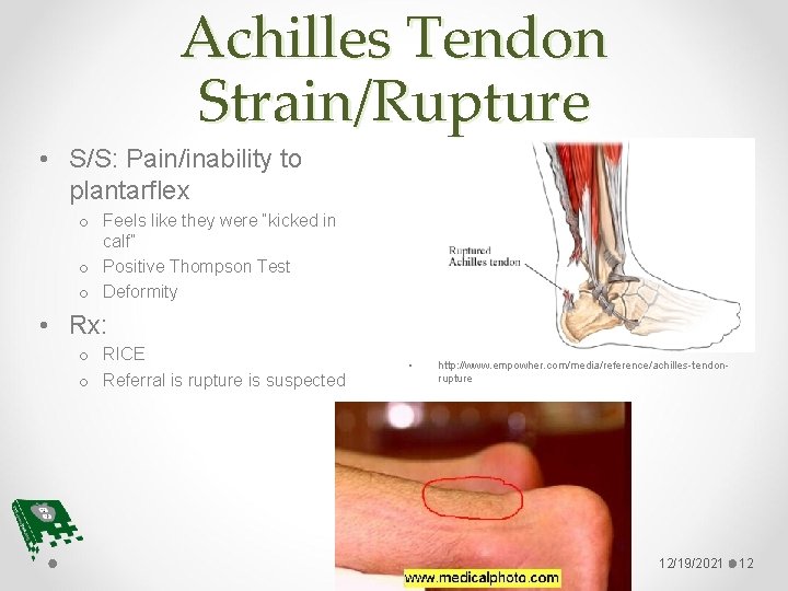 Achilles Tendon Strain/Rupture • S/S: Pain/inability to plantarflex o Feels like they were “kicked