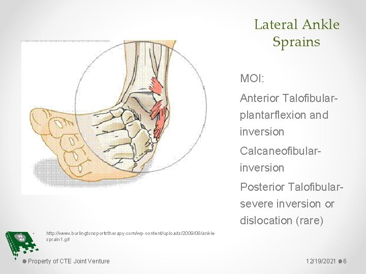 Lateral Ankle Sprains MOI: Anterior Talofibularplantarflexion and inversion Calcaneofibularinversion Posterior Talofibularsevere inversion or dislocation