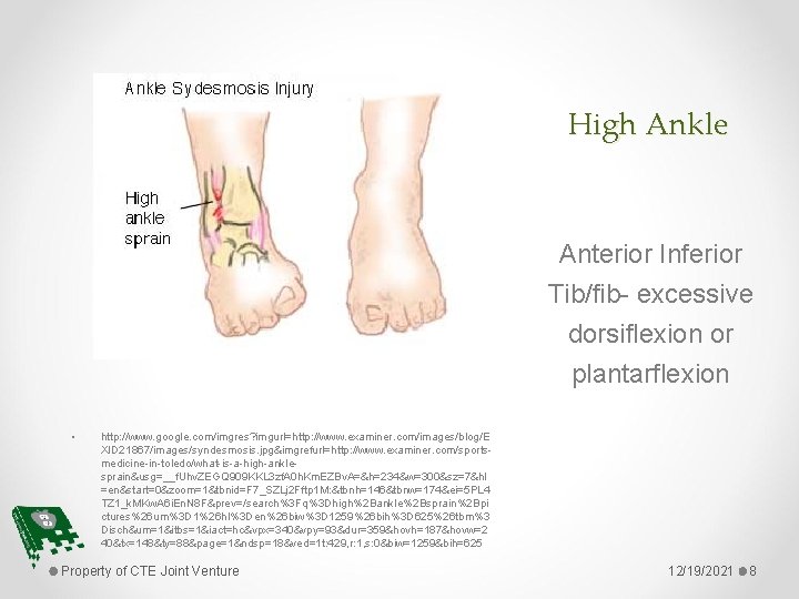 High Ankle Anterior Inferior Tib/fib- excessive dorsiflexion or plantarflexion • http: //www. google. com/imgres?