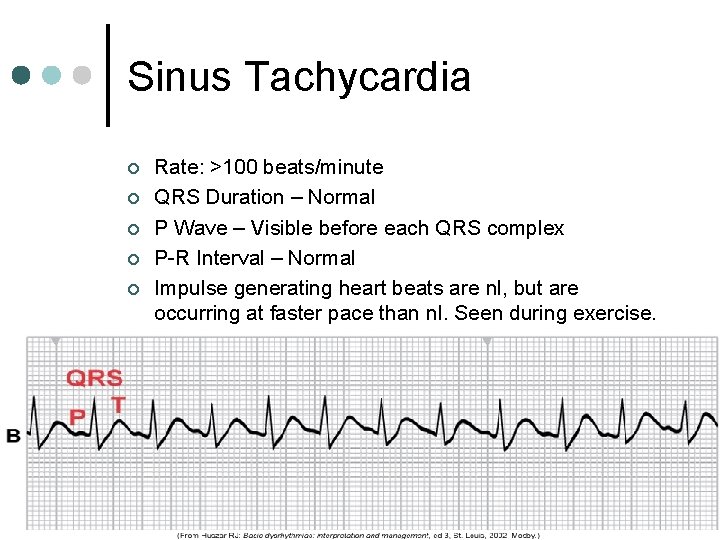 Sinus Tachycardia ¢ ¢ ¢ Rate: >100 beats/minute QRS Duration – Normal P Wave