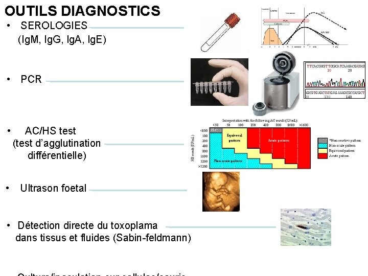 OUTILS DIAGNOSTICS • SEROLOGIES (Ig. M, Ig. G, Ig. A, Ig. E) • PCR