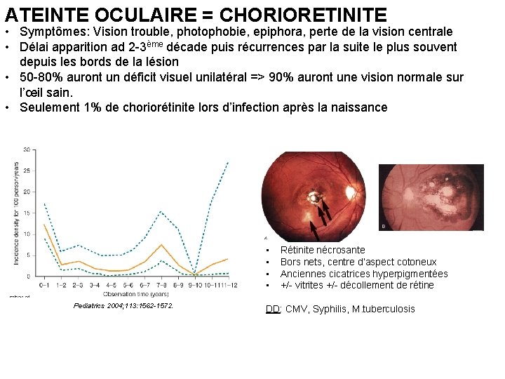 ATEINTE OCULAIRE = CHORIORETINITE • Symptômes: Vision trouble, photophobie, epiphora, perte de la vision