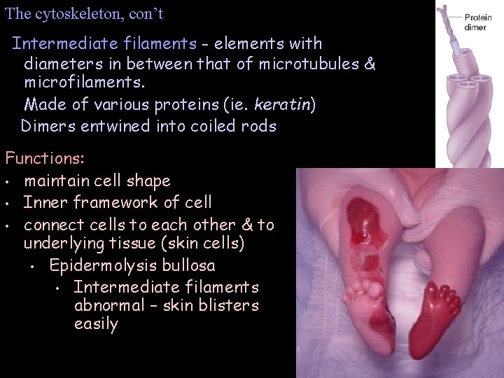 The cytoskeleton, con’t Intermediate filaments - elements with diameters in between that of microtubules The cytoskeleton, con’t Intermediate filaments - elements with diameters in between that of microtubules