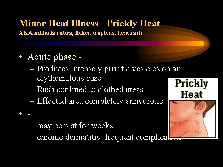 Minor Heat Illness - Prickly Heat AKA miliaria rubra, lichen tropicus, heat rash •