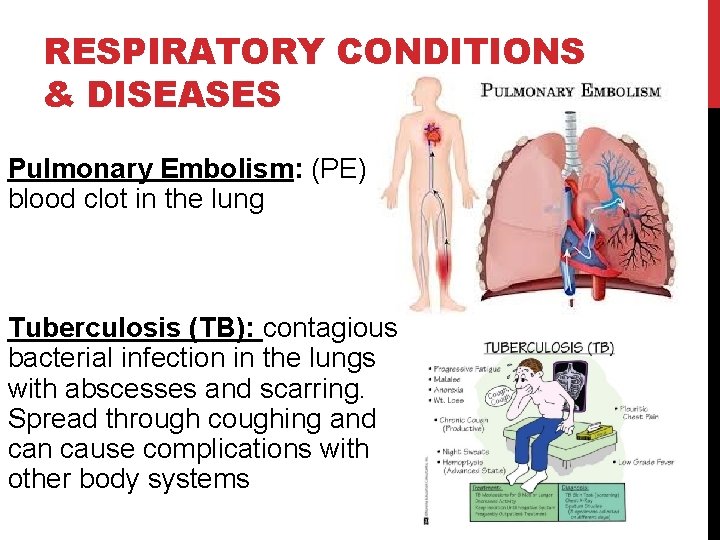 RESPIRATORY CONDITIONS & DISEASES Pulmonary Embolism: (PE) blood clot in the lung Tuberculosis (TB):