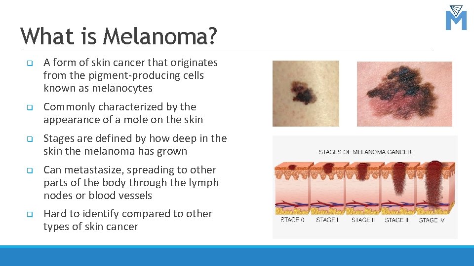 What is Melanoma? q q q A form of skin cancer that originates from