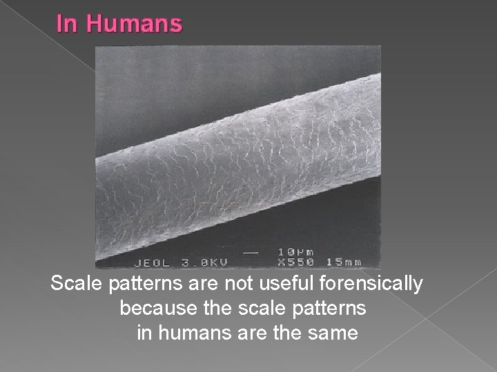 In Humans Scale patterns are not useful forensically because the scale patterns in humans