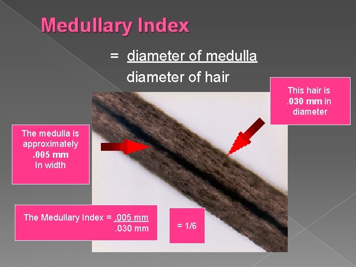 Medullary Index = diameter of medulla diameter of hair This hair is. 030 mm