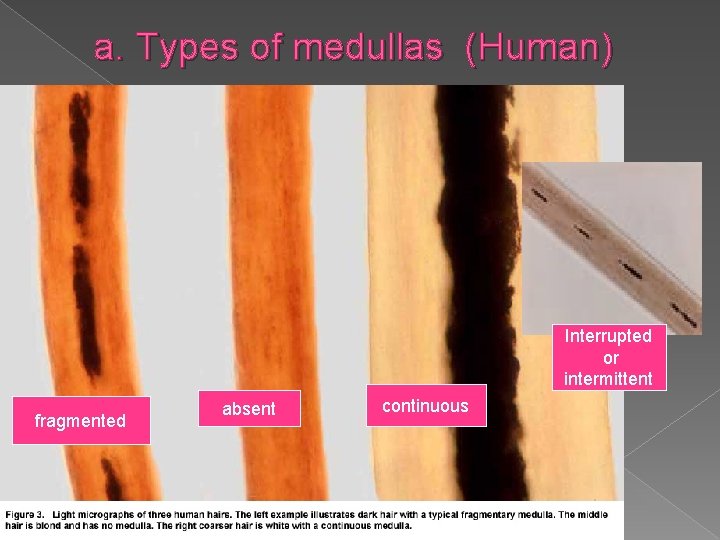 a. Types of medullas (Human) Interrupted or intermittent fragmented absent continuous 